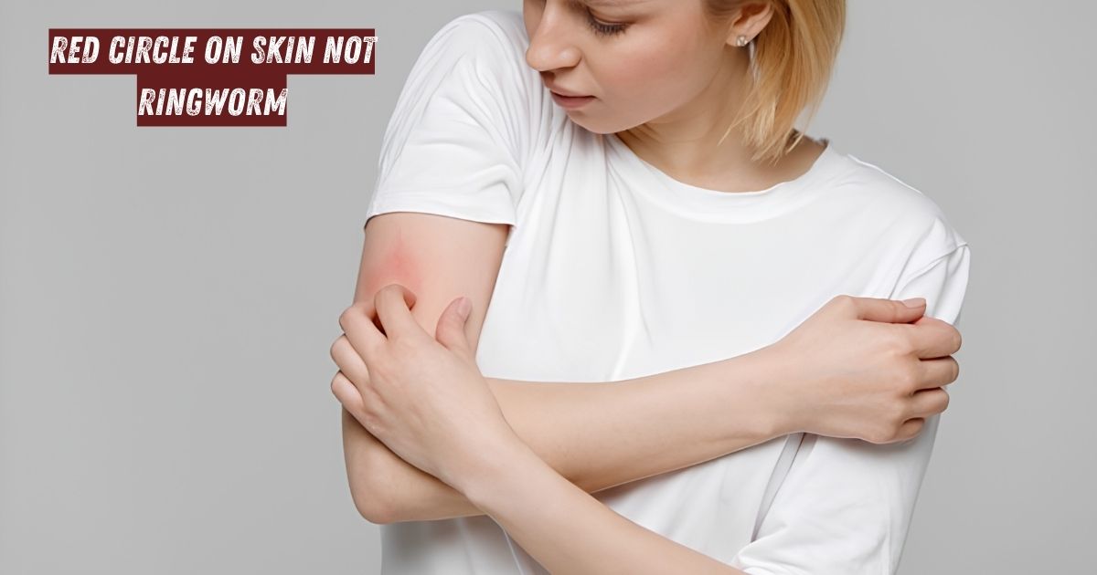 Red circle on skin not ringworm