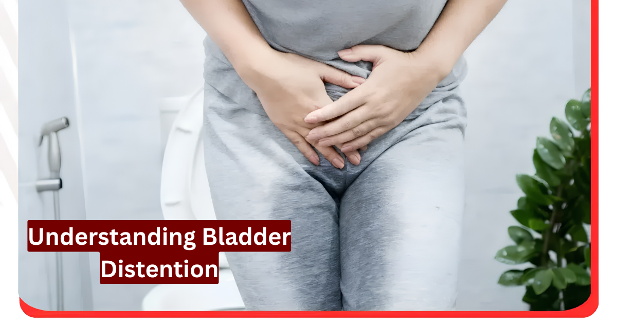 Understanding Bladder Distention