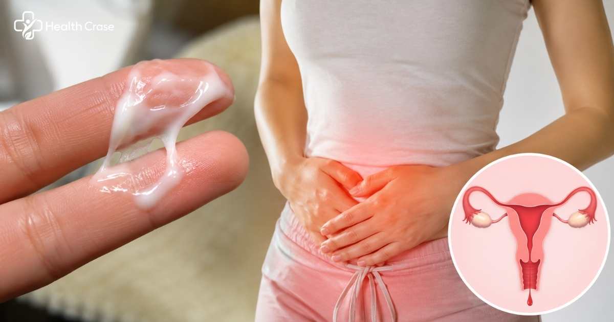 White Discharge Before Periods